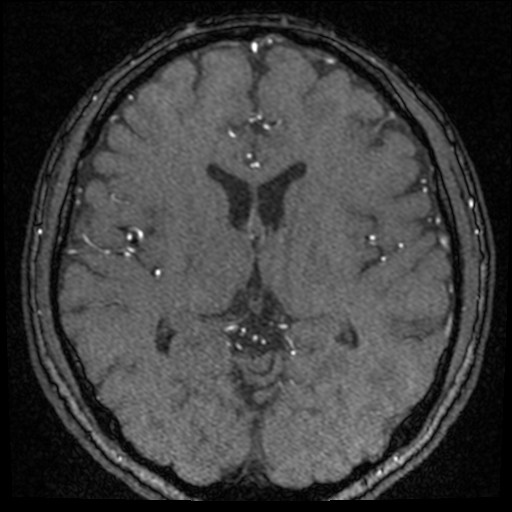 Click on the Serie image to view the images of VILLANUEVA, WILLIAM A.